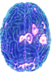Depressed-Brain